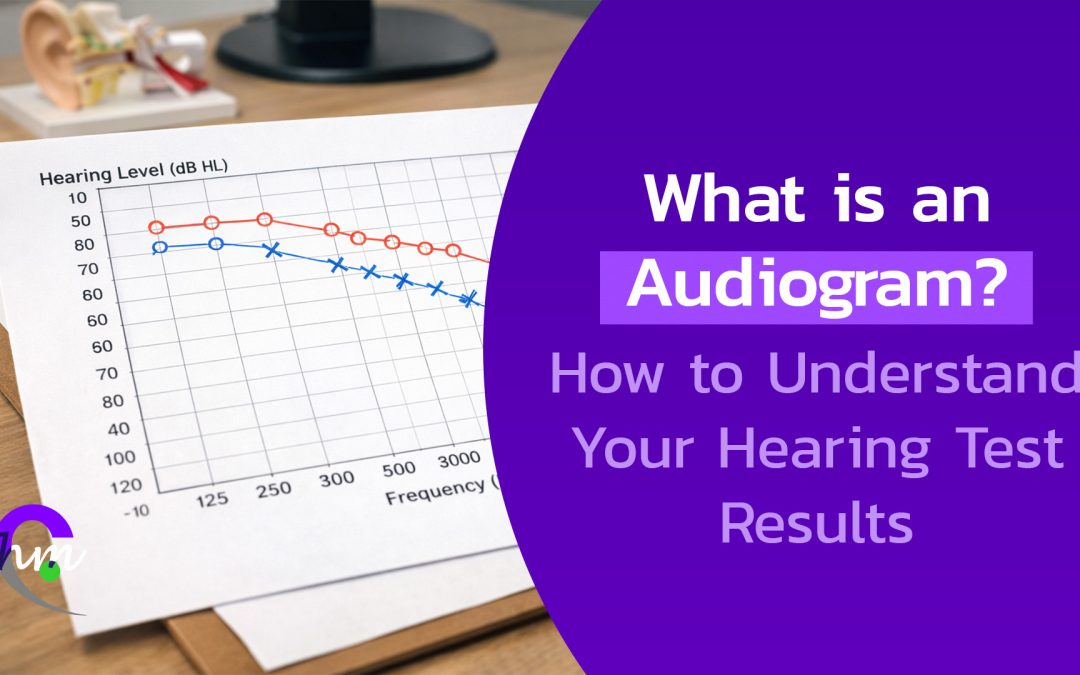 what is an audiogram
